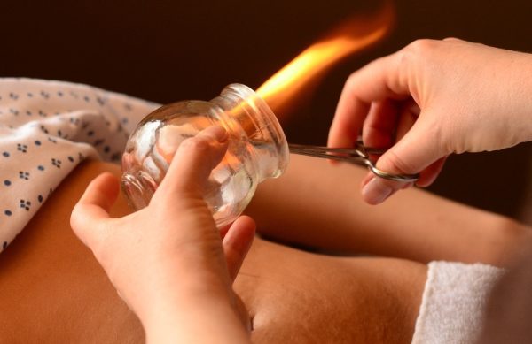 Workshop: Ventosaterapia Aromática — Método Raquel Costa